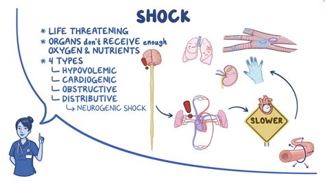 Shock - Neurogenic: Nursing - Osmosis Video Library