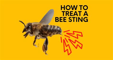 How To Treat A Bee Sting: Symptoms, Treatments & More