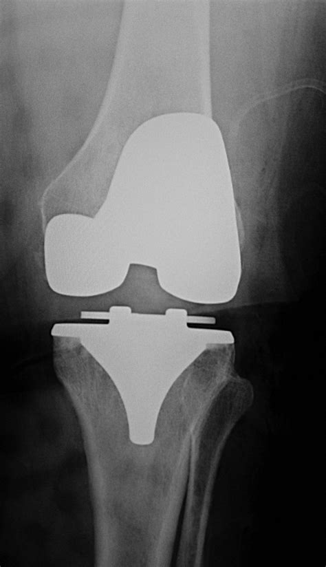 Medical Apparatus Imaging Guide