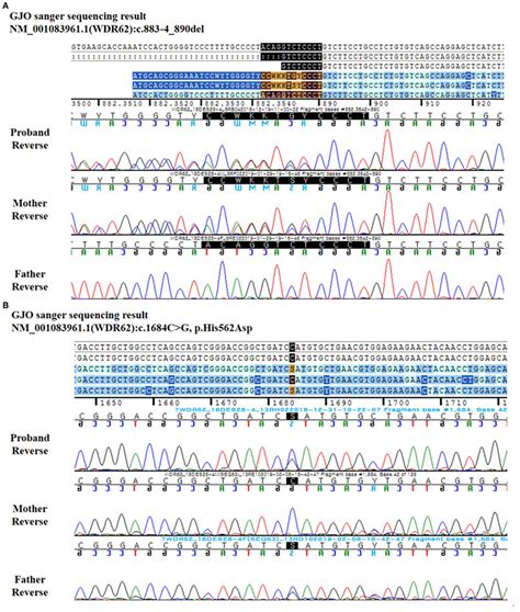 Reverse DNA sequence chromatography for the patient and her parents.... | Download Scientific ...