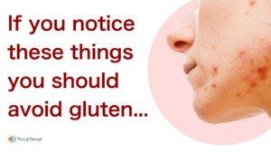 8 Signs You Have A Gluten Intolerance