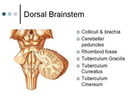 Brainstem I Medical Neuroscience Dr Wiegand Brainstem Lectures