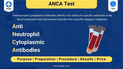 Antineutrophil Cytoplasmic Antibodies (ANCA) Test Explained - Drlogy