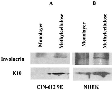 Keratinocyte differentiation markers in cells suspended in... | Download Scientific Diagram