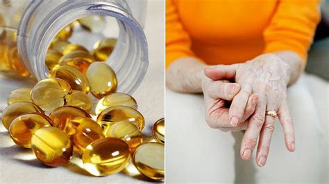 Arthritis and Vitamin D: What's the Connection? - Arthritis Center - Everyday Health