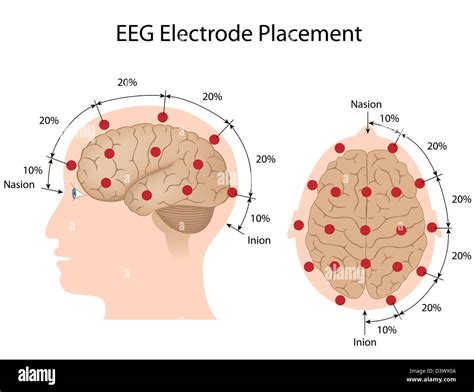 EEG electrode placement Stock Photo - Alamy