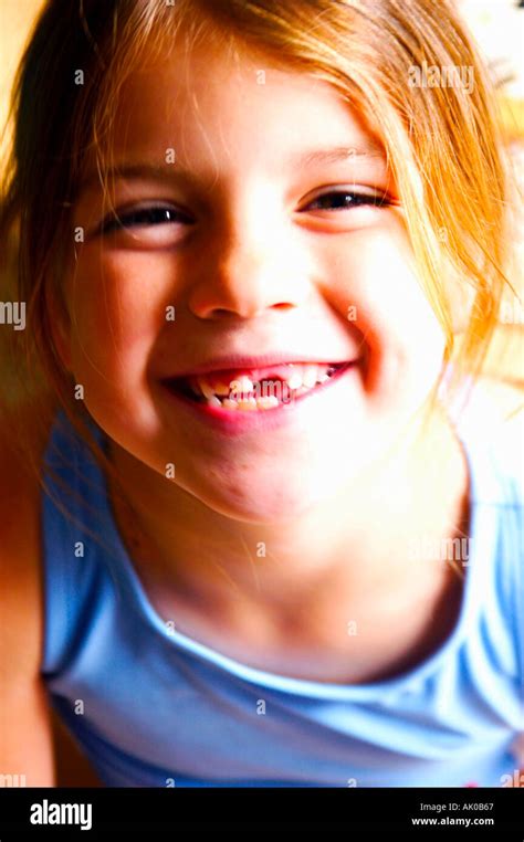 missing teeth smile Stock Photo - Alamy