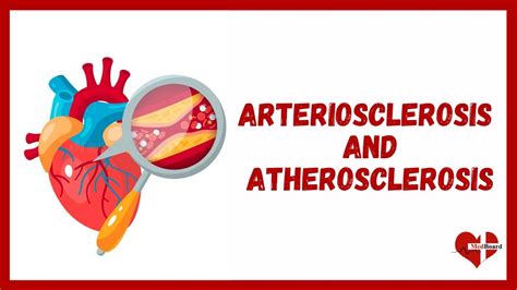 Arteriosclerosis Vs Atherosclerosis: Are They Different?, 49% OFF