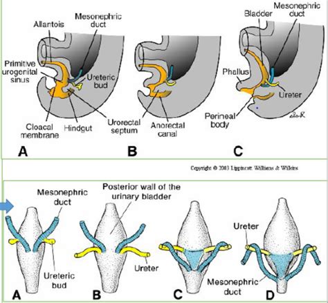 Bladder Exstrophy Embryology