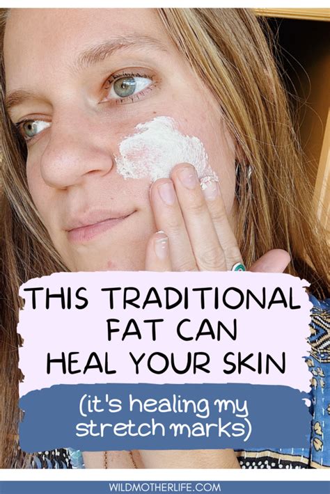 Tallow for Skin: What Are the Benefits? - Wild Mother