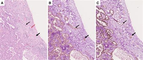 Parietal Pleura Histology