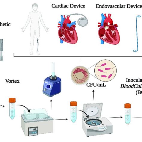 | Overview of sonication method for the diagnosis of implant-associated ...