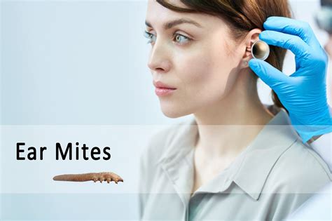 Ear Mites in Humans, Symptoms, and Treatment | Ungex