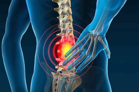 Is Chiropractic Care Effective for Back Pain?