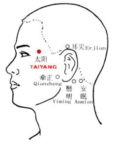 Taiyang EX-HN5: Location, Function, Indication, Method - Acupuncture Nepal