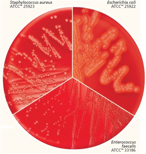 Columbia Agar Base - Interlab