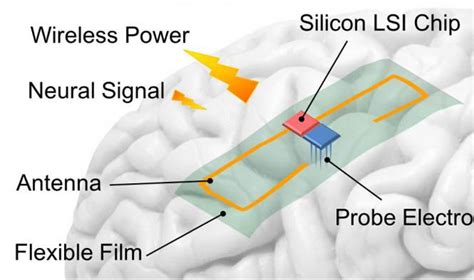 Brain Machine Interfaces Go Wireless - Asian Scientist Magazine