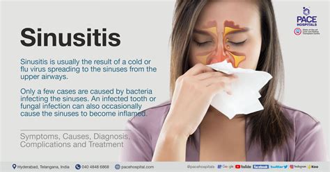 Fungal Sinusitis Causes Symptoms And Treatment Health | Hot Sex Picture