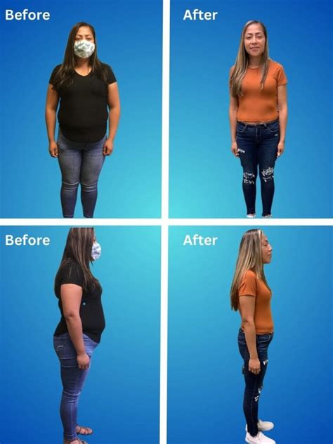 Semaglutide Weight Loss Orlando - (407) 804-5200