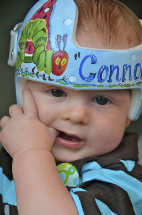 Pin by Leigh Gibson on Cranial Bands/Helmets | Doc band, Infant helmet designs boy, Doc band ...