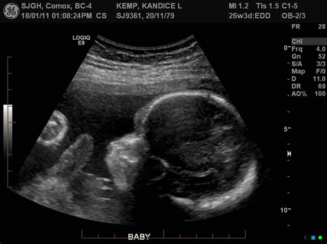 Baby Eschbaumer: Baby Ultrasound 26 weeks 3 days!