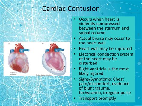 PPT - Chest Trauma PowerPoint Presentation, free download - ID:5319182