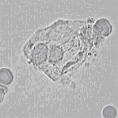 Bright Field Microscopy - Live Blood Online