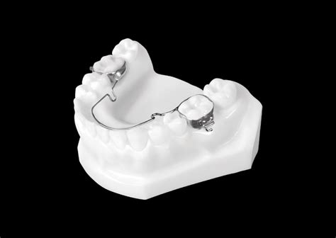 Lingual Holding Arch (Lower) - Universal Orthodontic Lab