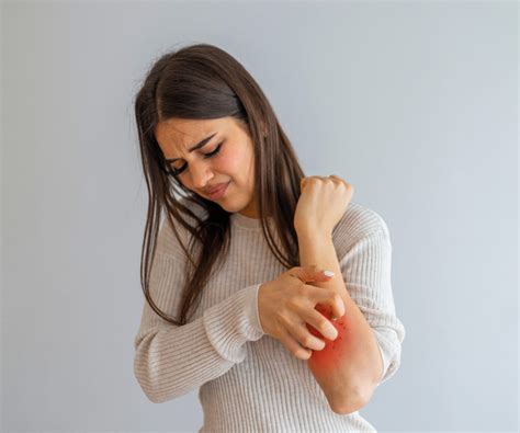 Vulgar Psoriasis: Causes, Symptoms, and Treatment