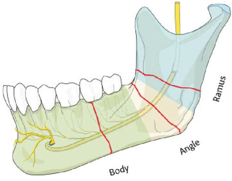 The image would show the locations of injury of inferior alveolar... | Download Scientific Diagram