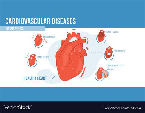 Flat cartoon infographic heart diseases Royalty Free Vector