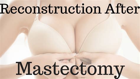 Reconstruction After Mastectomy - YouTube