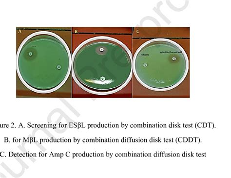 Actualizar 89+ imagen kirby bauer disc diffusion method procedure ...