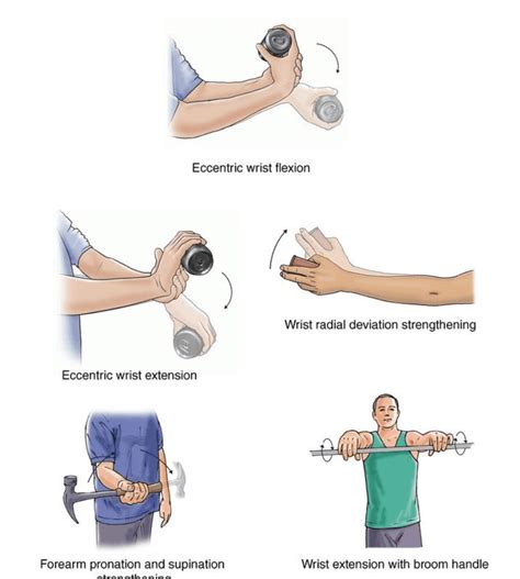 Exercises For Elbow Pain | GMphysio