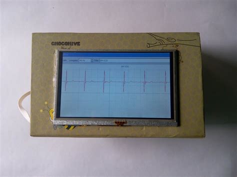 Portable ECG Machine : 9 Steps (with Pictures) - Instructables