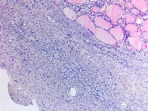 Pathology Outlines - Case #465