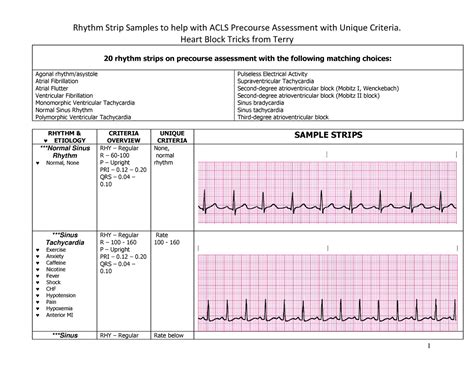 Cardiac Dysrhythmia Overview to help with week 2 - Heart Block Tricks ...