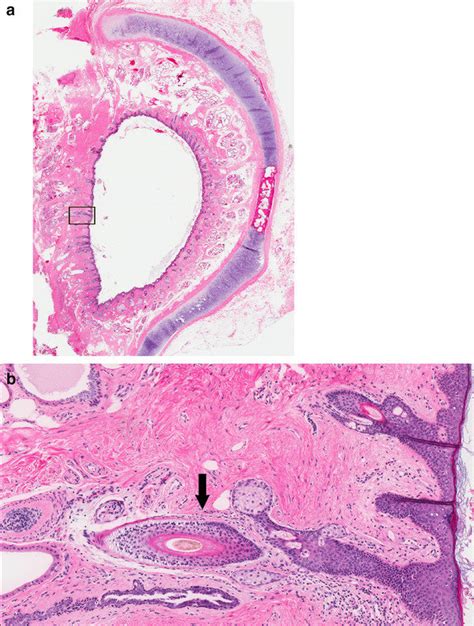 a Cross section of membranous (cartilaginous) external auditory canal ...