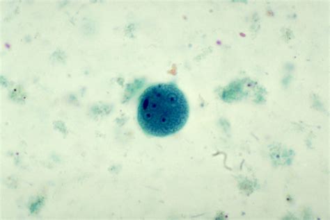 Public Domain Picture | This photomicrograph depicted a mature Entamoeba coli cyst, containing ...