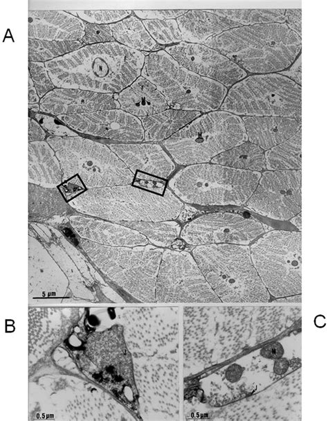 -Electron micrograph of a transverse section of the right group of the ...