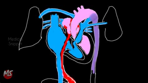 Fetal Circulation | Anatomy | Made easy | 3 minutes - YouTube