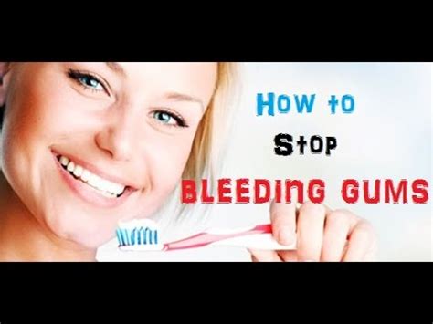 How to Stop Bleeding Gums | Home Remedies for Gum Disease - YouTube