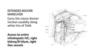 Management of abdominal vascular injury | PPT