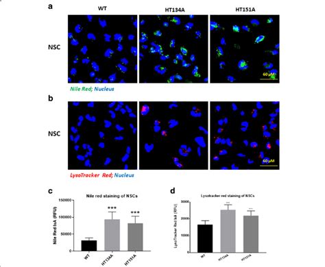 Nile Red and LysoTracker Red staining of TSD NSCs. a Images of ...