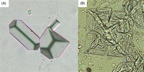 Two triple phosphate crystals: (A) coffin lid shape (x200). (B)... | Download Scientific Diagram