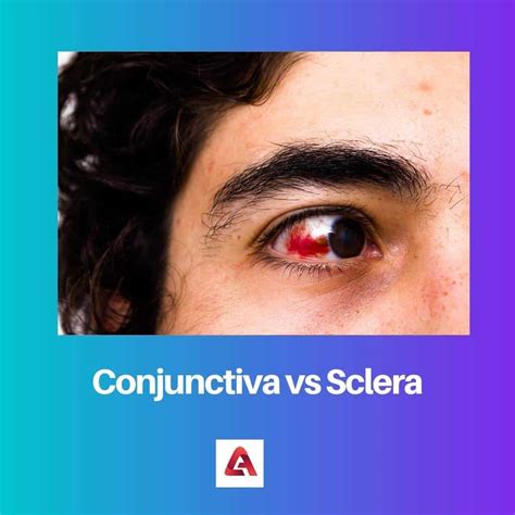 Conjunctiva vs Sclera: Difference and Comparison