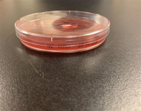 MacConkey Agar Plates (LOCAL ONLY) | Georgia Poultry Laboratory Network