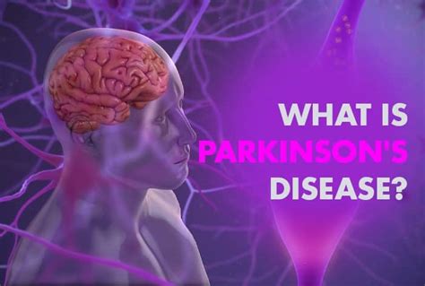 Parkinsons Disease is a Serious Brain Disorder| Is There Any Cure| All ...