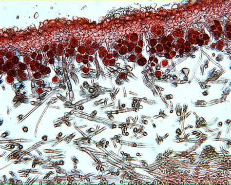 Lichen 400X: General Biology Lab: Loyola University Chicago