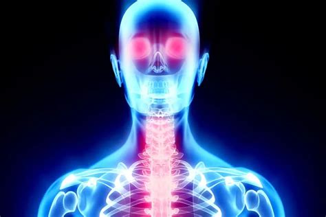 Neuromyelitis Optica vs. Multiple Sclerosis